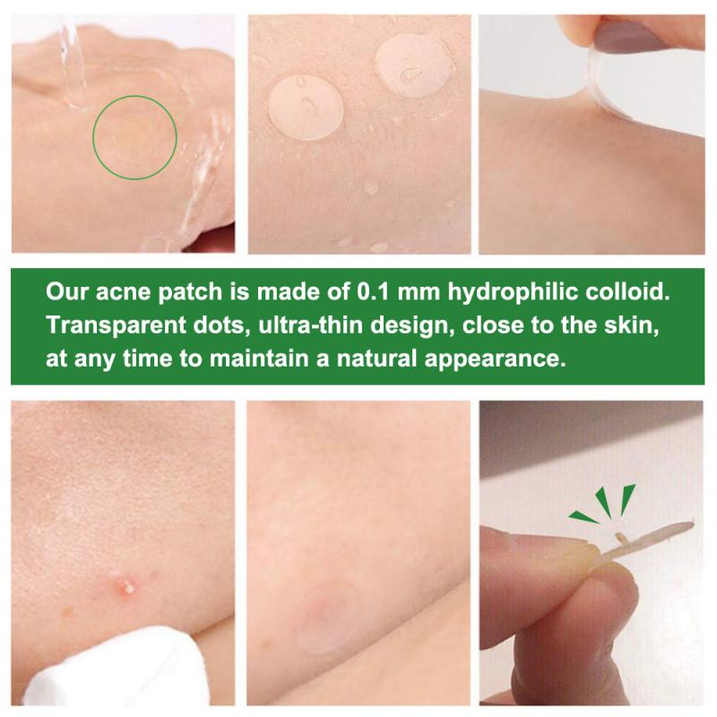 Acne Pimple Patch Sticker Acne Treatment Pimple Remover