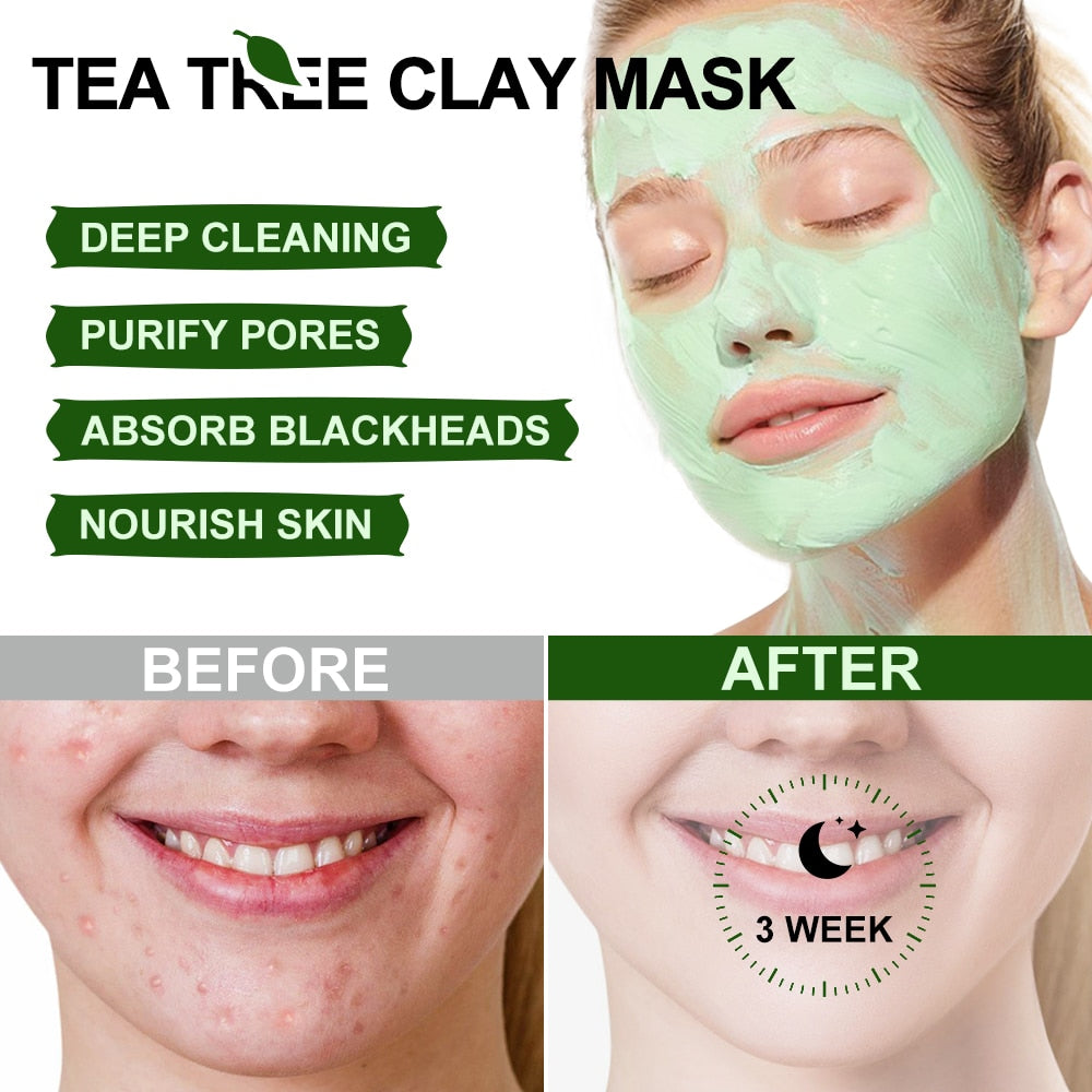 Acne Treatment Facial Mask Natural Tea Tree Pore Cleaning